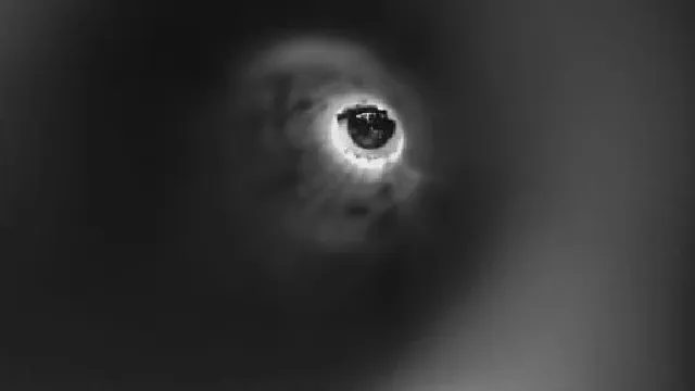 Eye